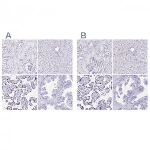Anti-LIN28B antibody produced in rabbit 