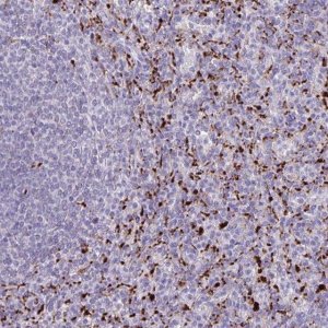 Anti-LIPA antibody produced in rabbit 