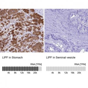 Anti-LIPF antibody produced in rabbit 