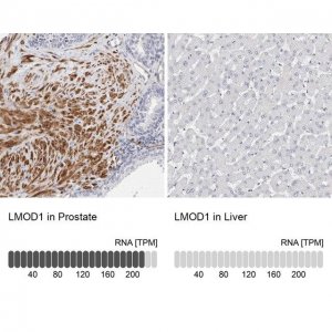 Anti-LMOD1 antibody produced in rabbit 