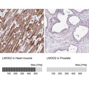 Anti-LMOD2 antibody produced in rabbit 