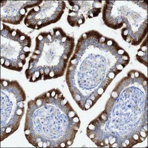 Anti-LOXL3 antibody produced in rabbit HPA035281-100UL