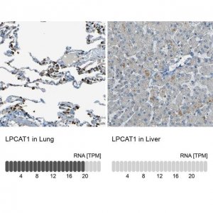 Anti-LPCAT1 antibody produced in rabbit 