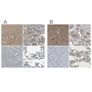 Anti-LPCAT1 antibody produced in rabbit 
