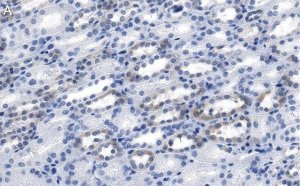 Anti-LPCAT1 Antibody, clone 1H15 ZooMAb Rabbit Monoclonal 