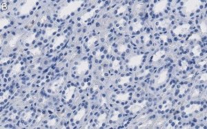 Anti-LPCAT1 Antibody, clone 1H15 ZooMAb Rabbit Monoclonal 