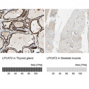Anti-LPCAT2 antibody produced in rabbit 