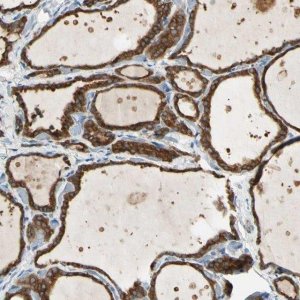 Anti-LPCAT2 antibody produced in rabbit 