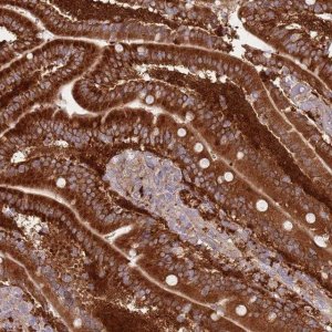 Anti-LPIN2 antibody produced in rabbit 
