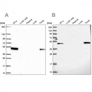 Anti-LPXN antibody produced in rabbit 