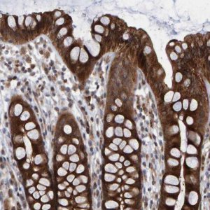 Anti-LRBA antibody produced in rabbit 