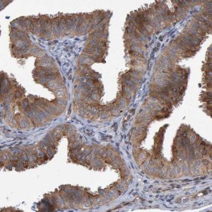 Anti-LRBA antibody produced in rabbit 