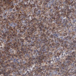 Anti-LRCH4 antibody produced in rabbit 