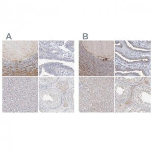 Anti-LRP2BP antibody produced in rabbit 