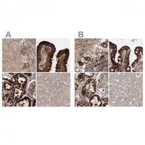 Anti-LRPPRC antibody produced in rabbit 