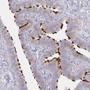 Anti-LRRC23 antibody produced in rabbit 