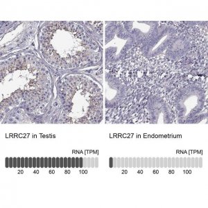 Anti-LRRC27 