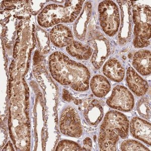 Anti-LRRC28 antibody produced in rabbit 