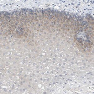 Anti-LRRC29 antibody produced in rabbit 