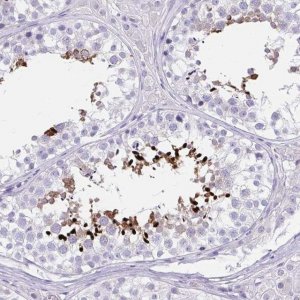 Anti-LRRC36 antibody produced in rabbit 