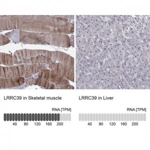 Anti-LRRC39 