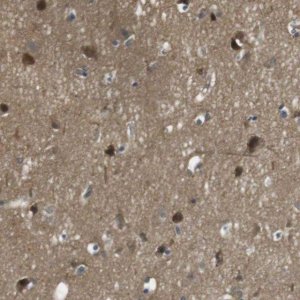 Anti-LRRC3B antibody produced in rabbit 
