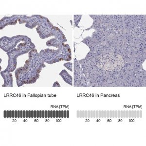 Anti-LRRC46 