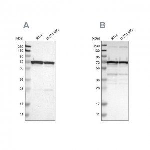 Anti-LRRC47 antibody produced in rabbit HPA008512-100UL