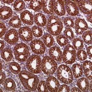 Anti-LRRC57 antibody produced in rabbit 