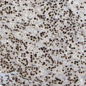 Anti-LRRC61 antibody produced in rabbit 