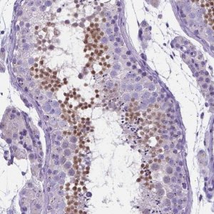 Anti-LRRC73 antibody produced in rabbit 