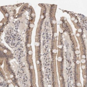 Anti-LRRC75A antibody produced in rabbit 