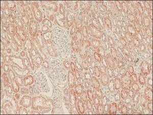 Anti-LRRK2 (C-terminal region) antibody produced in rabbit 