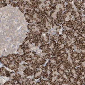 Anti-LRRN2 antibody produced in rabbit 
