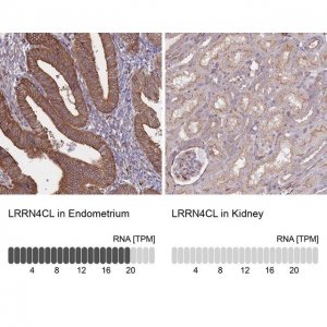 Anti-LRRN4CL antibody produced in rabbit 