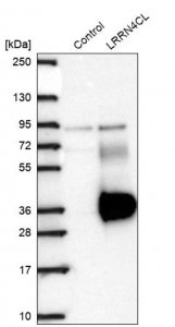 Anti-LRRN4CL antibody produced in rabbit 