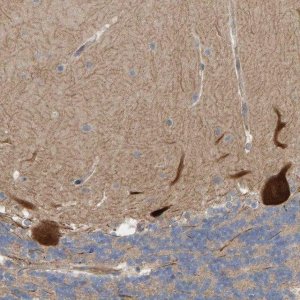 Anti-LRSAM1 antibody produced in rabbit 