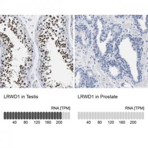 Anti-LRWD1 antibody produced in rabbit 