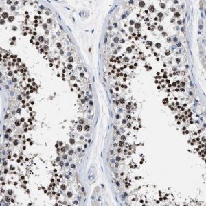 Anti-LRWD1 antibody produced in rabbit 