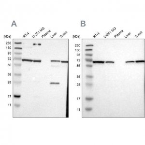 Anti-LTA4H antibody produced in rabbit 
