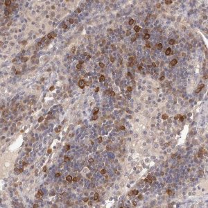 Anti-LTV1 antibody produced in rabbit 