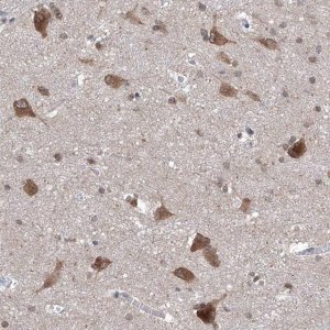 Anti-LURAP1 antibody produced in rabbit 
