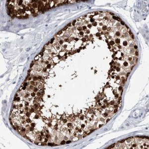 Anti-LURAP1L antibody produced in rabbit 