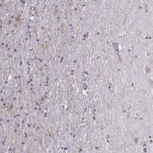 Anti-LUZP2 antibody produced in rabbit 