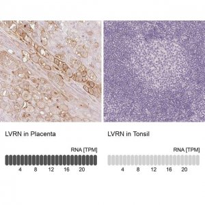 Anti-LVRN antibody produced in rabbit 
