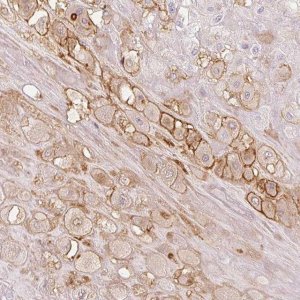 Anti-LVRN antibody produced in rabbit 