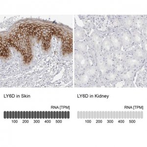 Anti-LY6D antibody produced in rabbit 