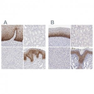 Anti-LY6D antibody produced in rabbit 