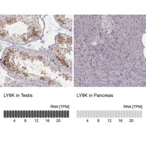 Anti-LY6K antibody produced in rabbit 