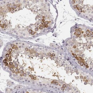 Anti-LY6K antibody produced in rabbit 